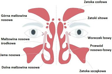 Przewlekłe zapalenie zatok – etiopatogeneza i leczenie